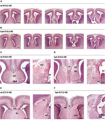 A selective defect in the glial wedge as part of the neuroepithelium disruption in hydrocephalus development in the mouse hyh model is associated with complete corpus callosum dysgenesis